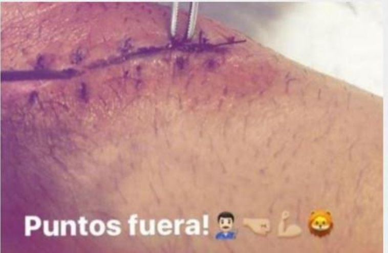 ברטרה והתפרים. העיקר שנגמר בשלום