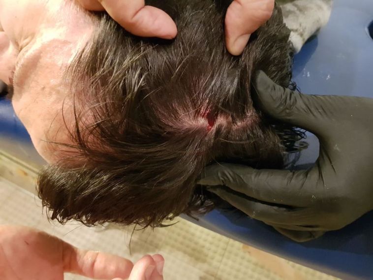 מאמן פאוק סלוניקי נפגע בראשו מאמן פאוק סלוניקי נפגע בראשו