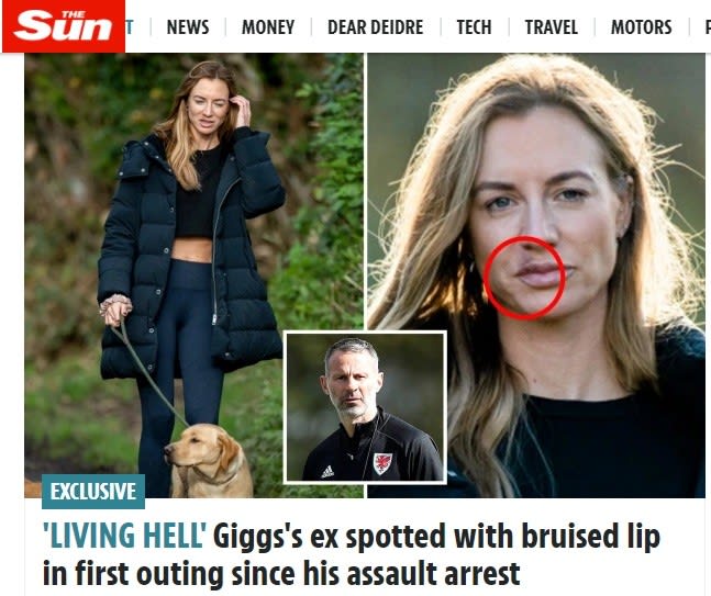 "סאן" מפרסם - תמונה של קייט גארוויל, בת זוגו לשעבר של ריאן גיגס