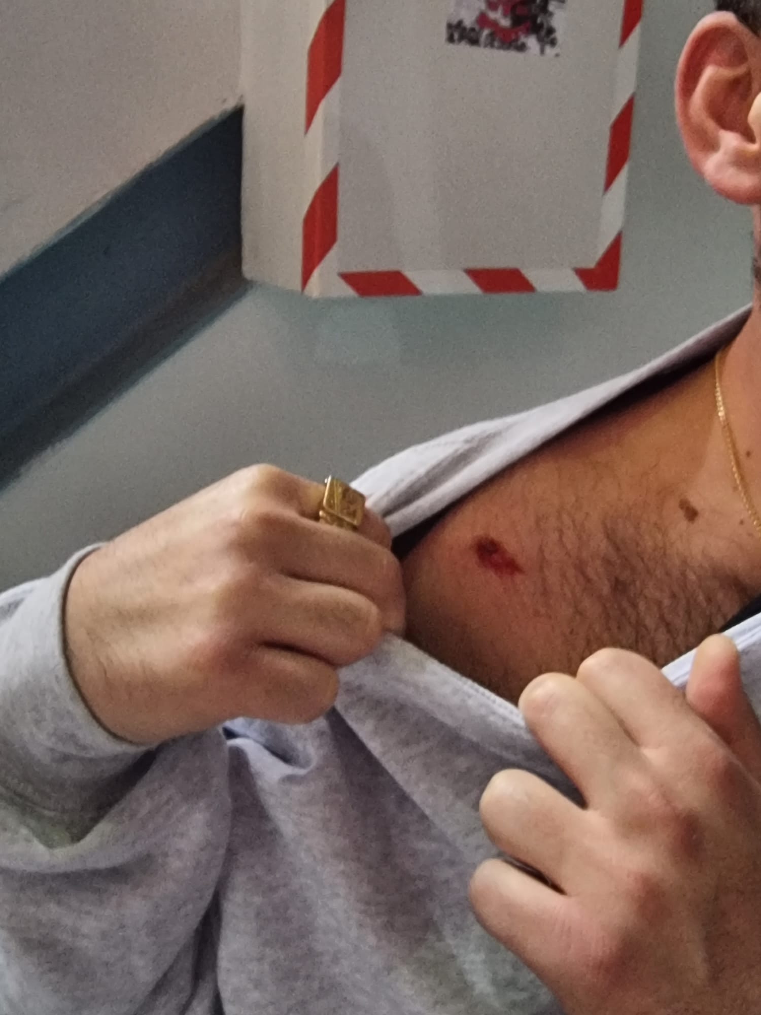 אוהד הפועל ירושלים נפגע באתונה