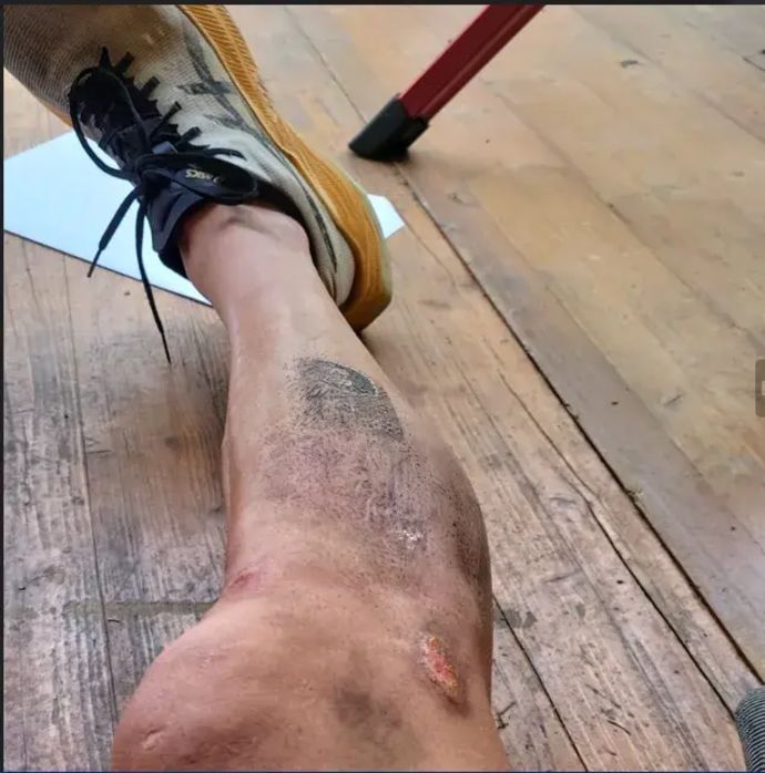 הרגל של שחר שגיב