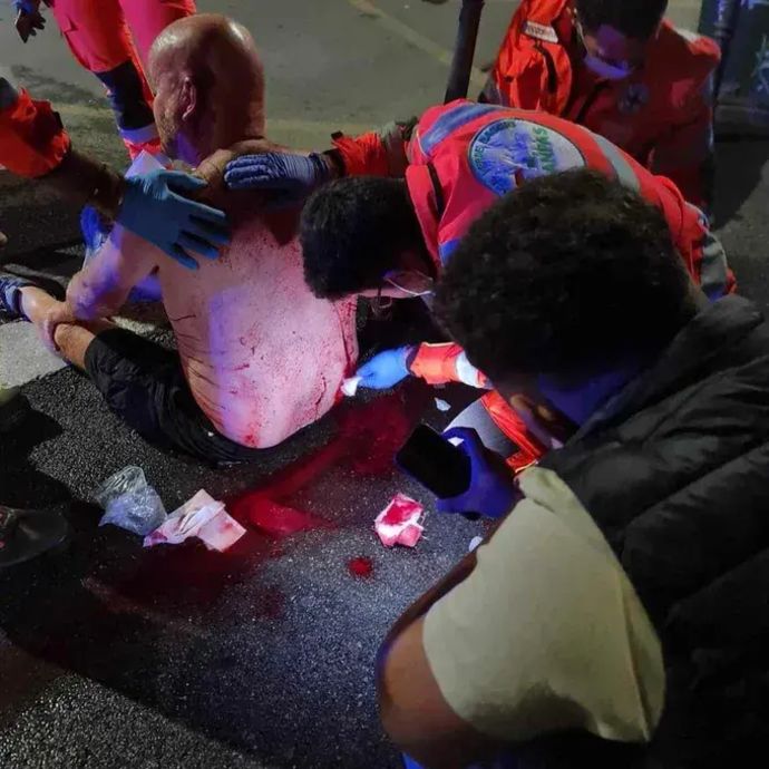 אוהד ניוקאסל אחרי שנדקר על ידי אוהדים של מילאן