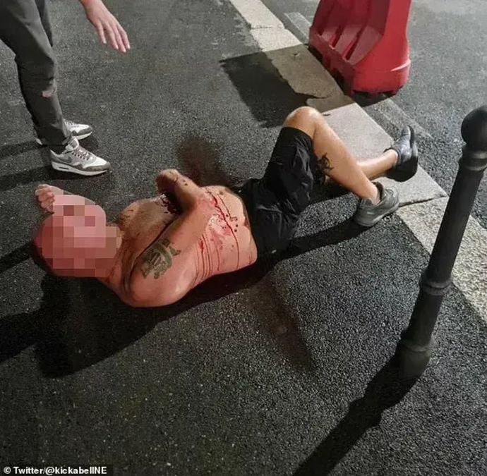 אוהד ניוקאסל אחרי שנדקר על ידי אוהדים של מילאן