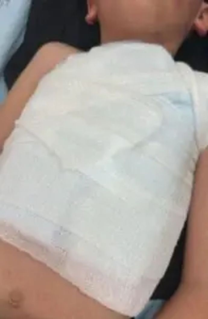 אוהד בית"ר ירושלים שנפצע מזיקוקים באצטדיון טדי