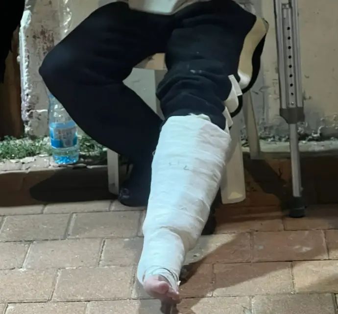 אוהדי בית"ר ירושלים שחשוד שהחביא אמצעים פירוטכניים בגבס