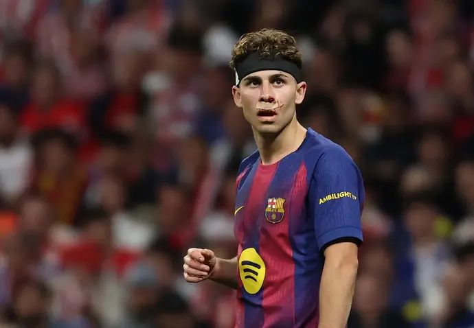 פרמין לופס שחקן ברצלונה לאחר שנפצע בפניו