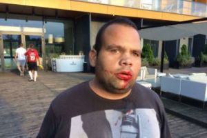 אירוע מכוער בפולין