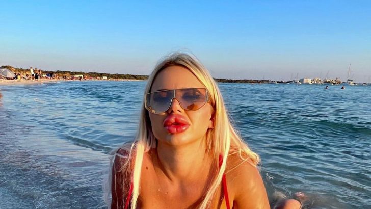 האישה "בעלת החזה הגדול באוסטריה"