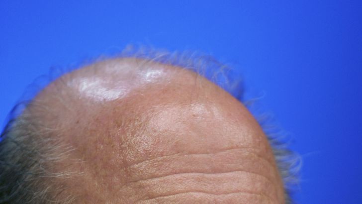 בלאטר. הפרישה שלו היא רק חלק מהשינוי הנדרש