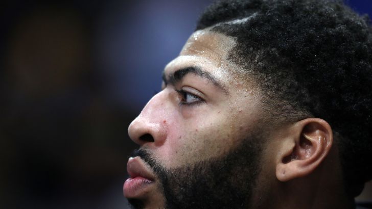 אנתוני דיוויס