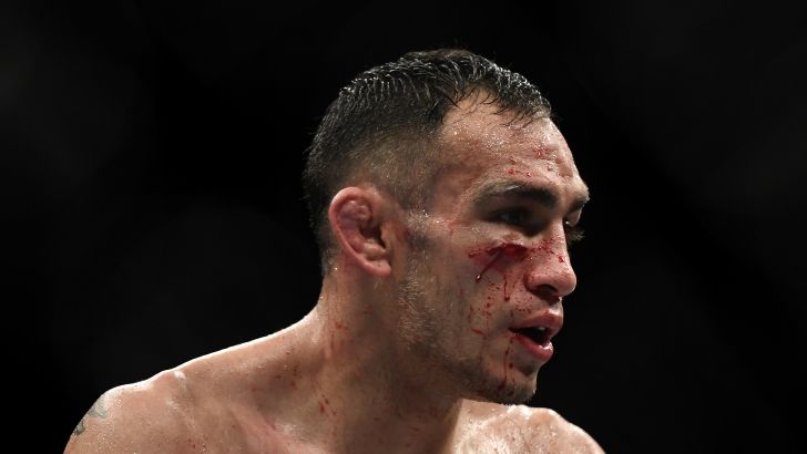 טוני פרגוסון